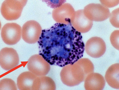 <p><strong>granular leukocytes: basophils</strong></p><ul><li><p>absorb basic stain → blue-purple</p><ul><li><p>2 lobed nuclei</p></li><li><p>granules obscure nuclei</p></li></ul></li><li><p>life span: 1-2 years</p></li><li><p>chemotaxic</p></li><li><p>degranulation</p><ul><li><p>_____, _____, and _____</p></li></ul></li><li><p>stimulate the formation of IgE on mast cells</p><ul><li><p>anaphylaxis</p></li></ul></li><li><p>allergies and ectoparasites</p><ul><li><p>ticks</p></li></ul></li><li><p>>1% of WBCs (least abundant)</p></li></ul><p></p>