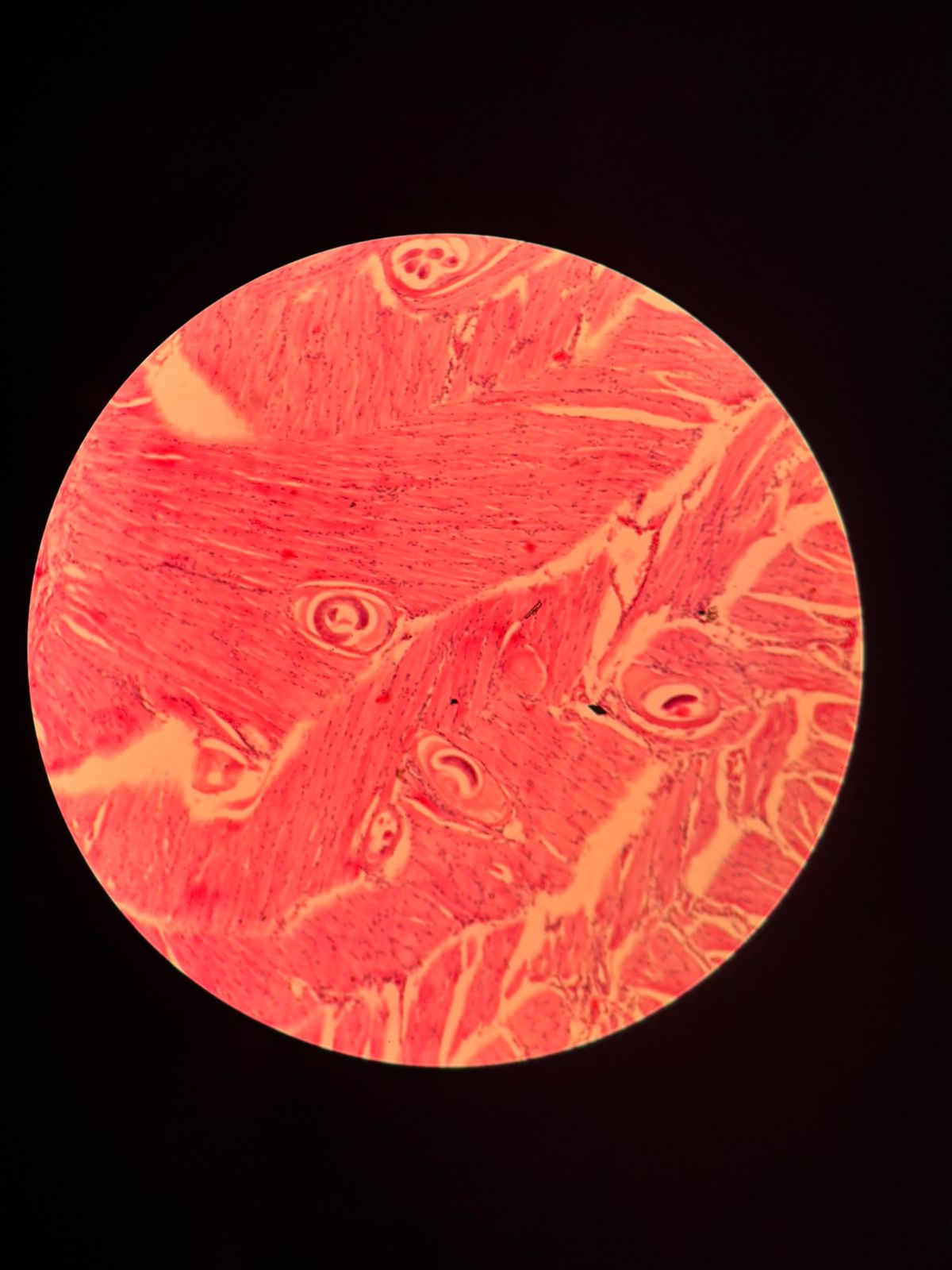 term image