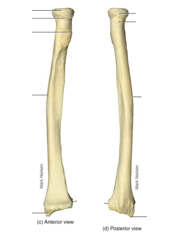 <p>Identify the bone features of the radius</p>