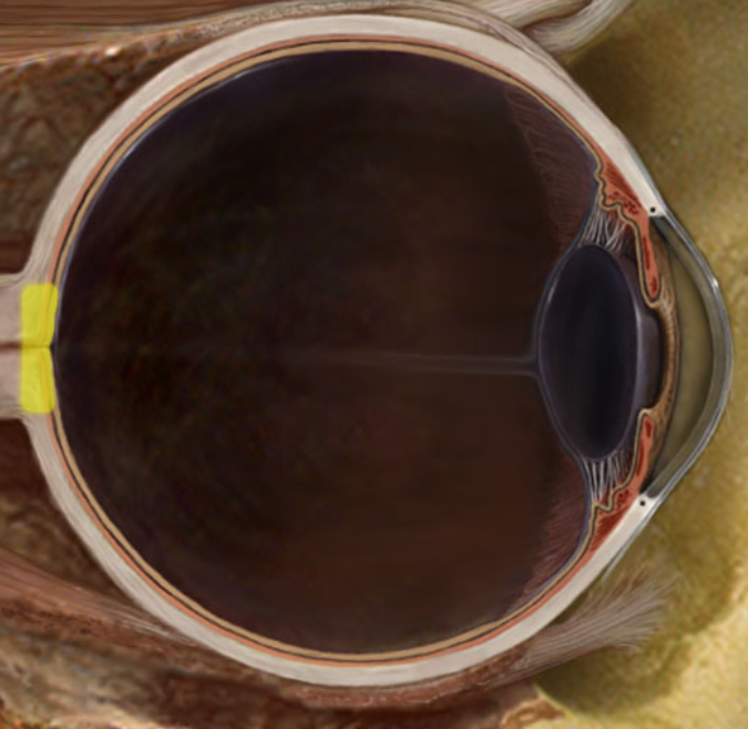 term image