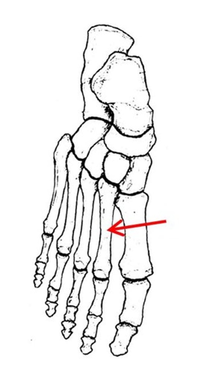 <p>ID specific bone</p>