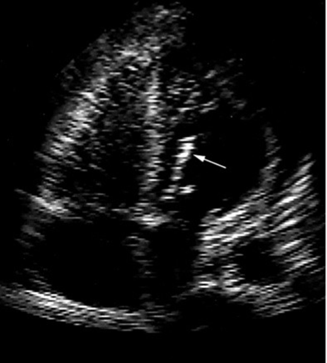 <p>What is represented by this image</p>