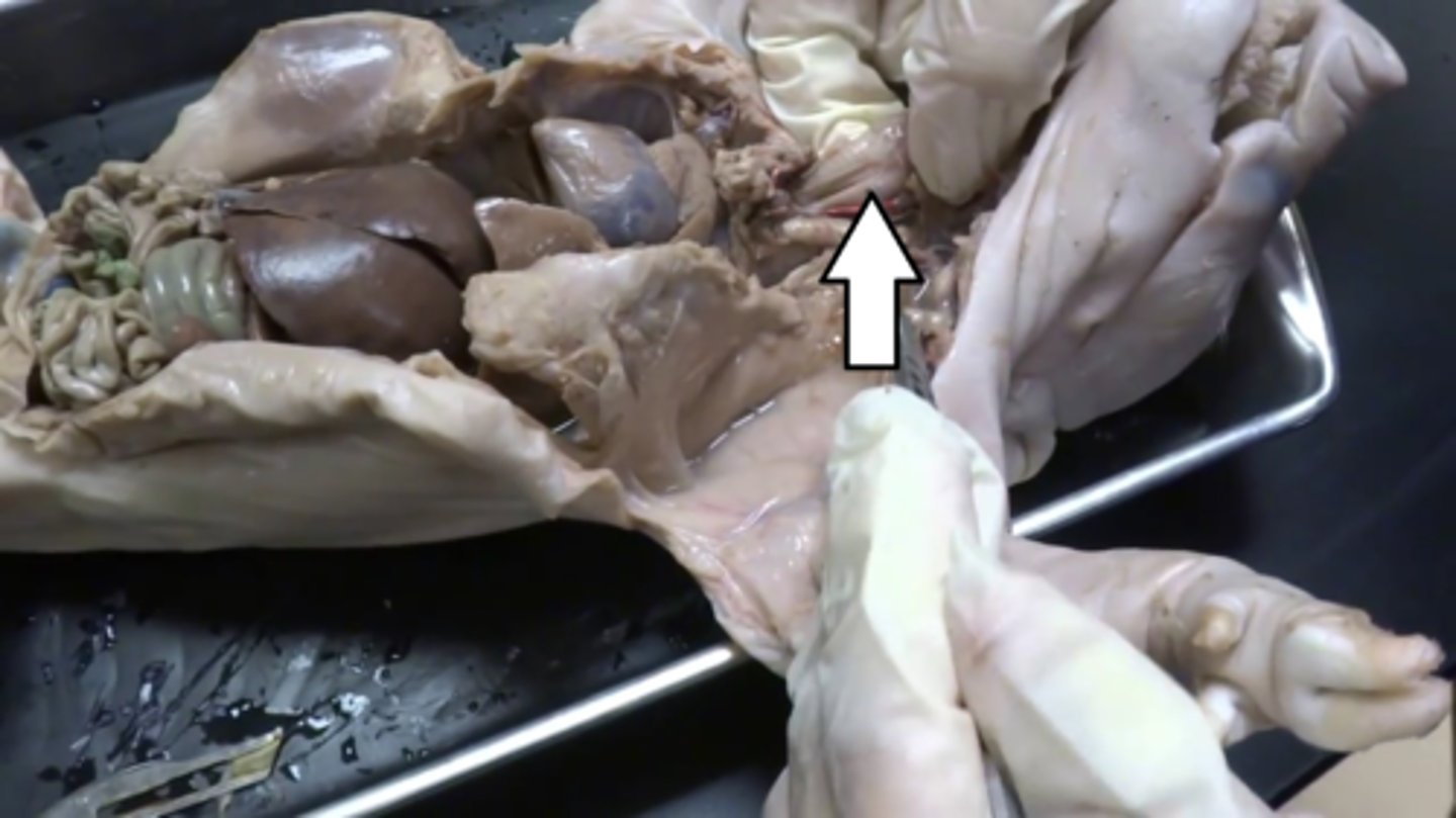 <p>Digestive System; A muscular tube that connects the mouth to the stomach.</p>