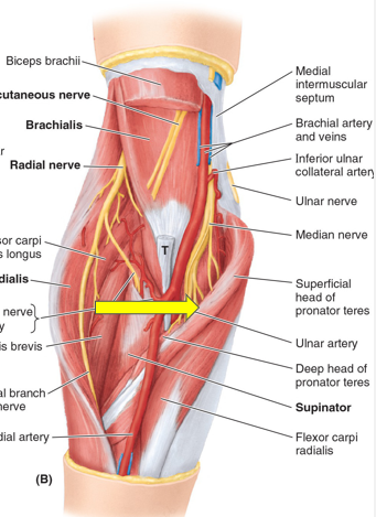 <p>Anterior Interosseous Nerve (AIN) arises from median nerve at lower border of cubital fossa at Pronator Teres Muscle. It traverses distally along interosseous membrane between</p>