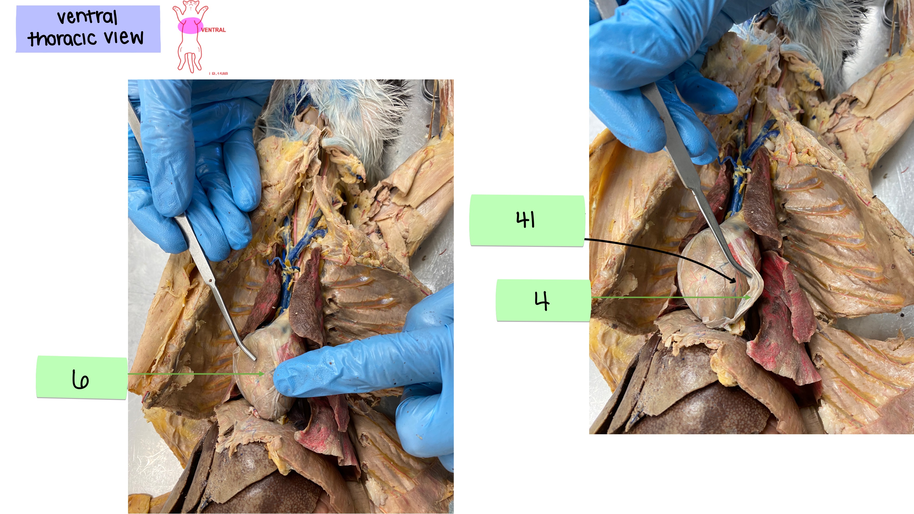 <p>anterior ventricular artery</p>