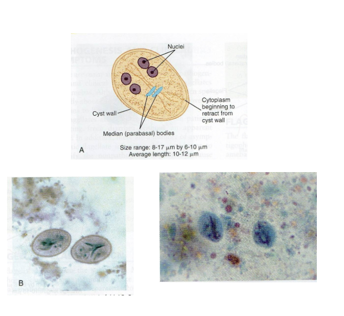 <p>What are morphology features of Giardia cysts?</p>