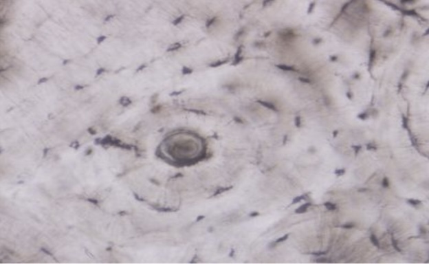 <p>a type of connective tissue that provides structural support and protection for organs, characterized by a mineralized extracellular matrix. It plays a key role in the skeletal system and houses bone marrow. </p>