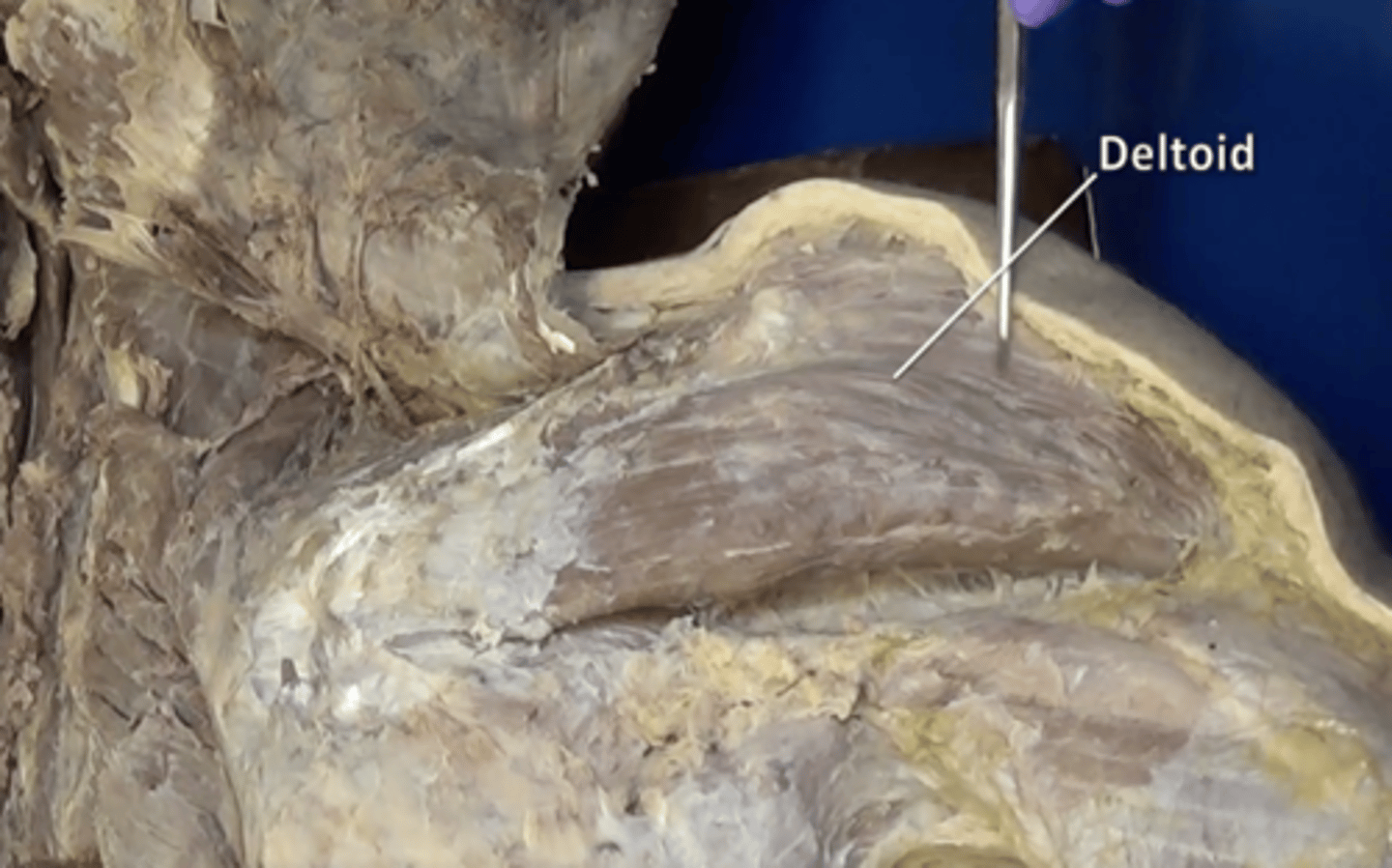 <p>forms the muscular cap of the shoulder</p>