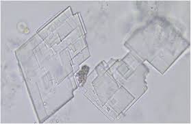 <ul><li><p>colorless</p></li><li><p>flat, notched rectangles</p></li><li><p>rarely seen</p></li><li><p>associated with tissue breakdown and renal disease</p></li></ul><p></p>