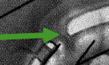 <p>paired; connects the lateral ventricles with the third ventricle </p>