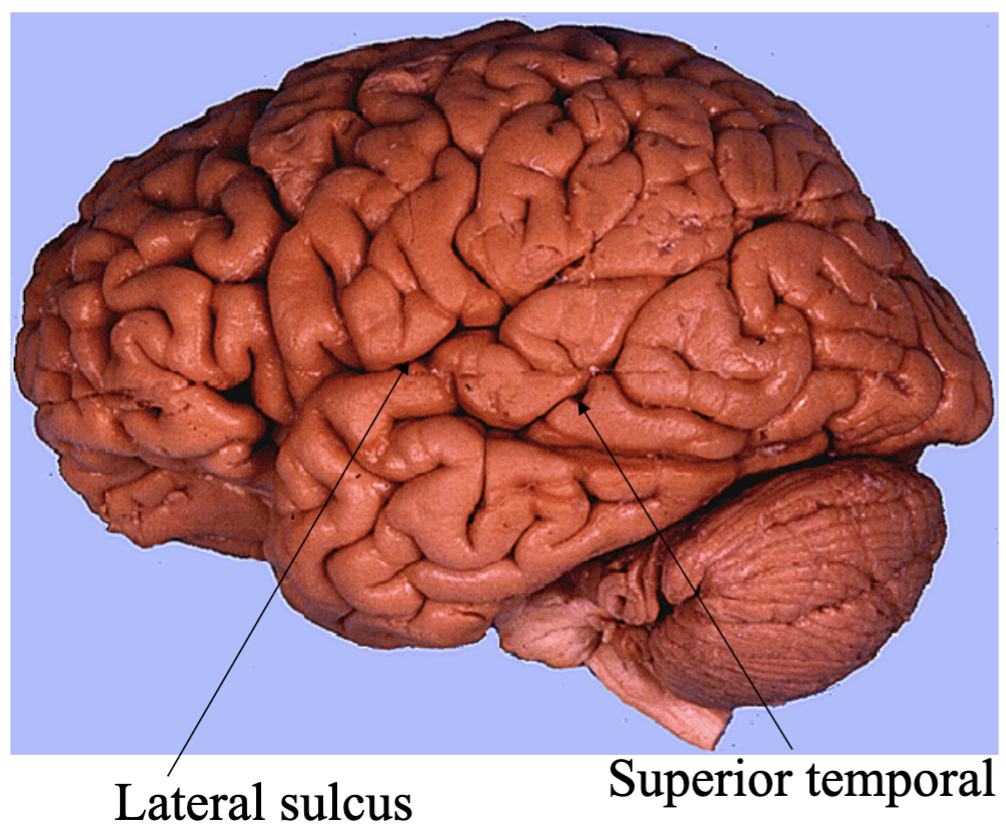 <ul><li><p>The Lateral Sulcus (or fissure) separates superior temporal gyrus from the frontal and parietal lobes</p></li><li><p>Superior temporal sulcus is found centrally on the temporal lobe</p></li></ul><p></p>