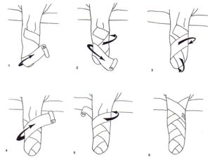 <ul><li><p><strong>Disadvantages: </strong>Requires skill and experience for proper application</p><ul><li><p><span style="color: red;"><span>Can slip and form a tourniquet effect</span></span></p></li></ul></li><li><p><strong><span>Advantages: </span></strong><span>Inexpensive, Light Weight, Readily Available</span></p></li></ul><p></p>