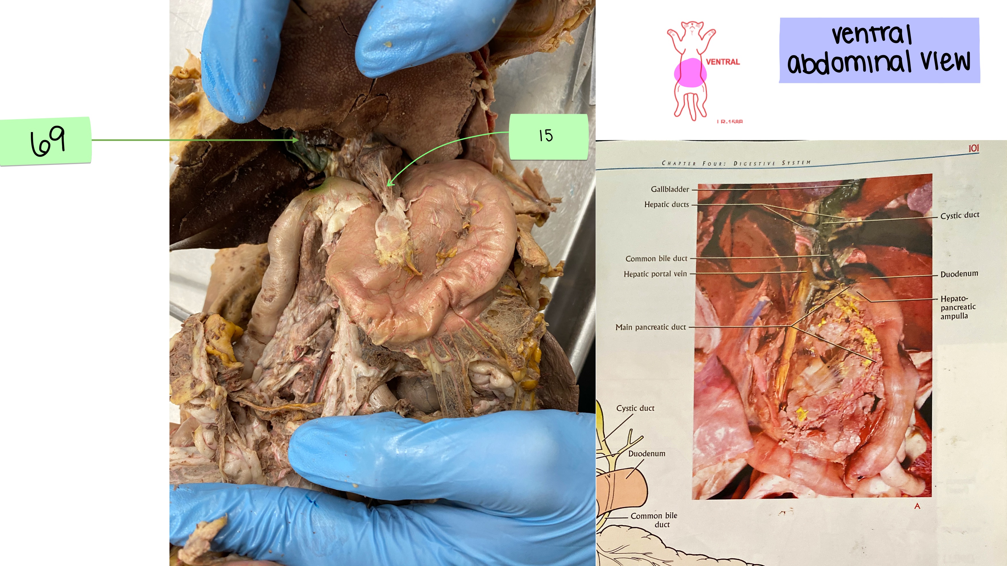 <p>gastrohepatic ligament</p>