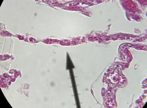 <p>what type of tissue is this </p>