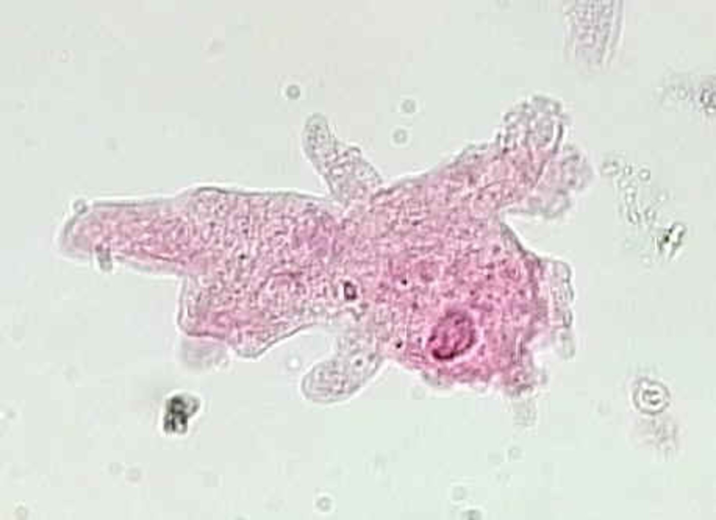 <p>A type of protist characterized by great flexibility and the presence of pseudopodia.</p>
