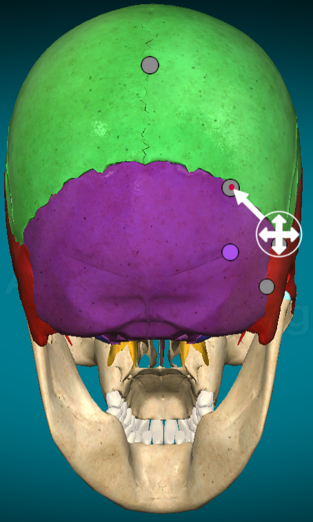 <p>Lamboid suture: separates parietal bones from occipital bone</p>