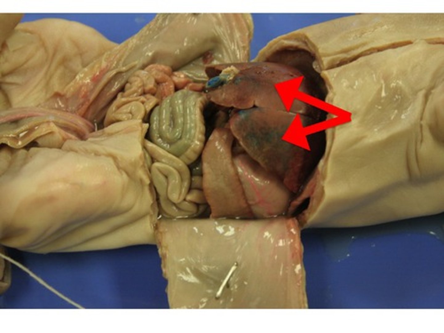 <p>This organ breaks down ingested toxins and the byproducts of protein metabolism and is also a storage site for glycogen.</p>