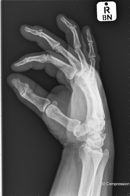 <p>Describe the abnormality demonstrated. </p>