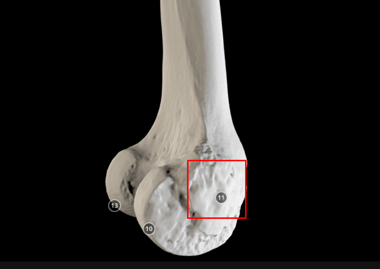 <p>medial epicondyle (of femur) - above medial condyle</p>