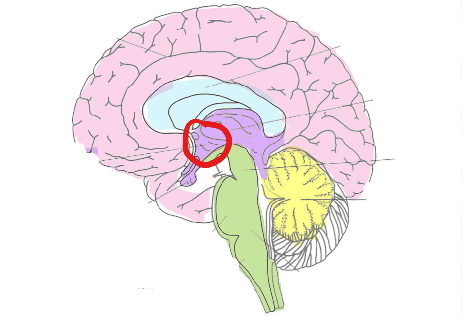 term image