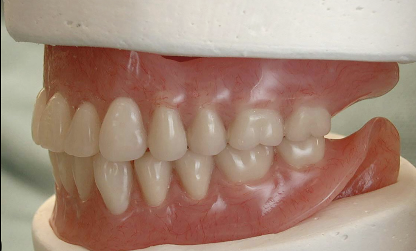 <p>maximum contact between the occluding surfaces of the maxillary and mandibular teeth</p>