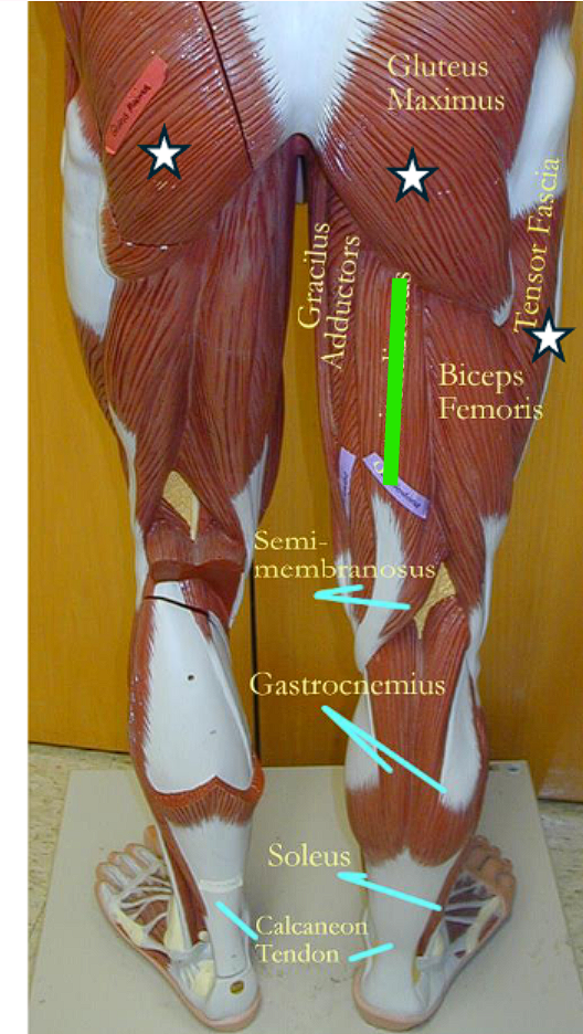 <ul><li><p>flexes the leg and extends the thigh </p></li></ul><p></p>