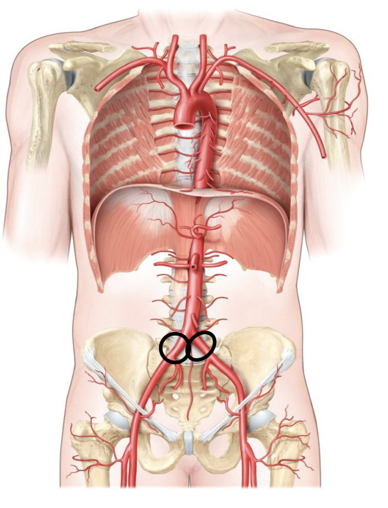 <p>The terminal branches of the abdominal aorta that supply blood to the pelvis and lower limbs.</p>
