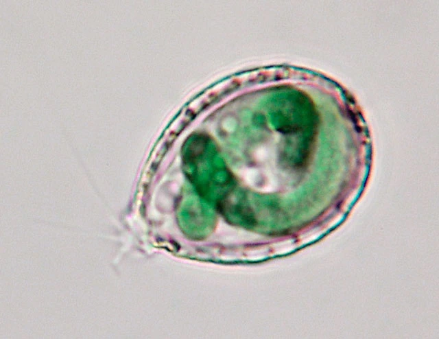 <p>Which protist is this?</p>