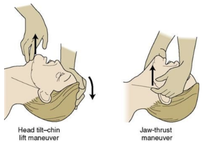<ul><li><p><span>While the general rule is to always leave a person's head, neck, or spine in the position found without any movement or alignment with the body → <strong>if the person is unresponsive and not breathing, giving CPR must take precedence over not moving the head or neck</strong></span></p></li><li><p><span>Perform a </span><span style="color: blue"><strong>jaw thrust</strong></span><span> to open the airway instead of a head-tilt-chin-lift technique</span></p></li></ul><p></p>