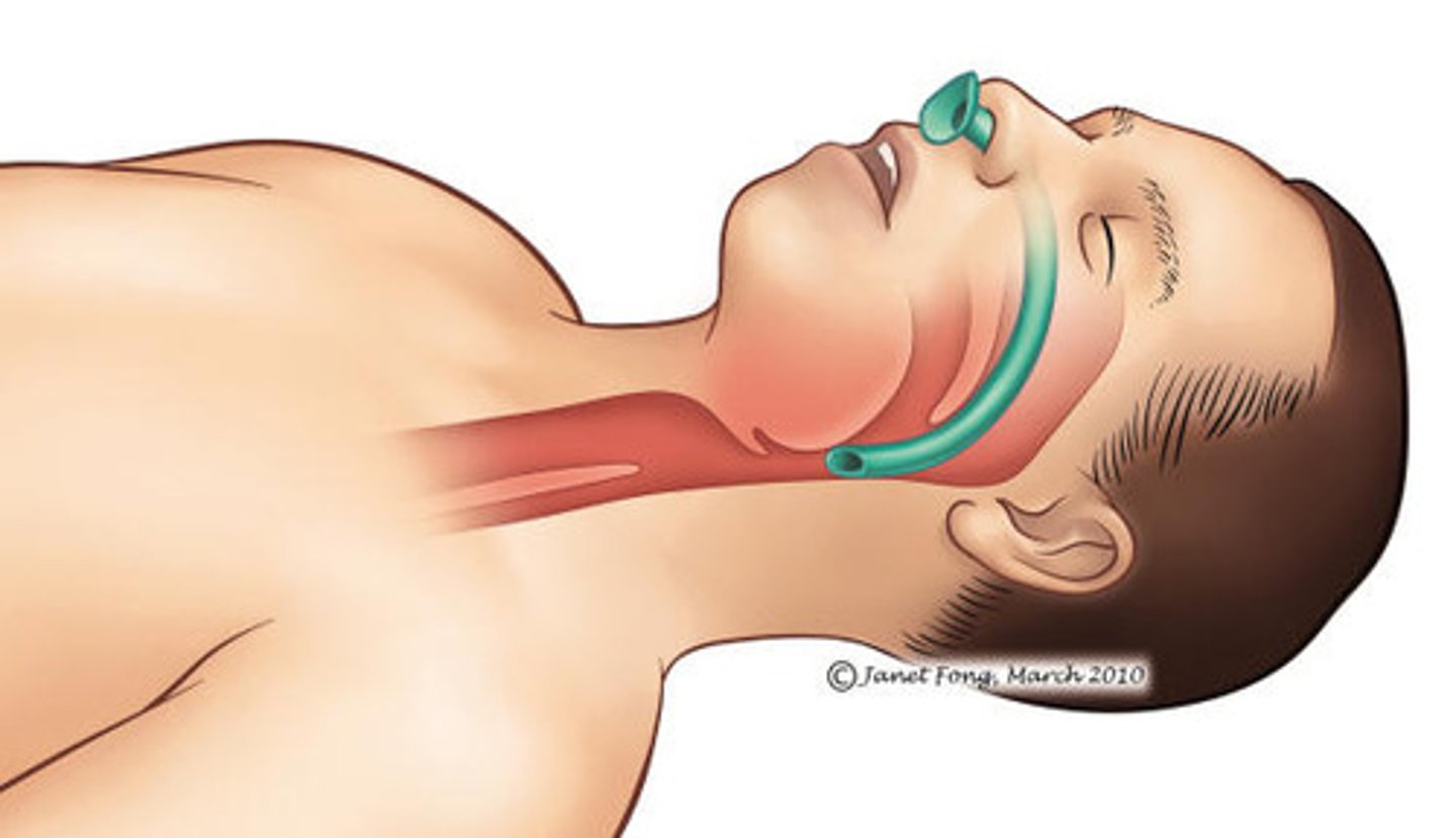 <p>A flexible tube that is inserted into a patient's nose to provide an open airway</p>
