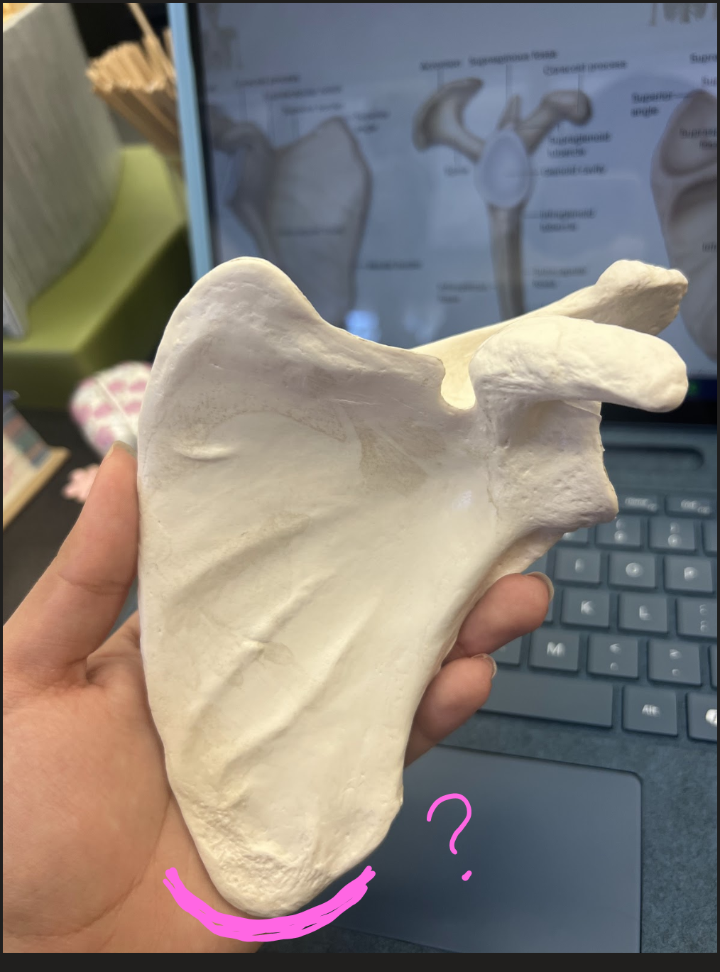 <p>What is this marked area?</p>