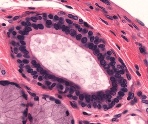 <p>What type of epithelium is present in the image?</p>