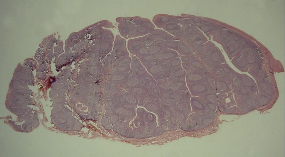 <p><span>Amígdala palatina</span></p>