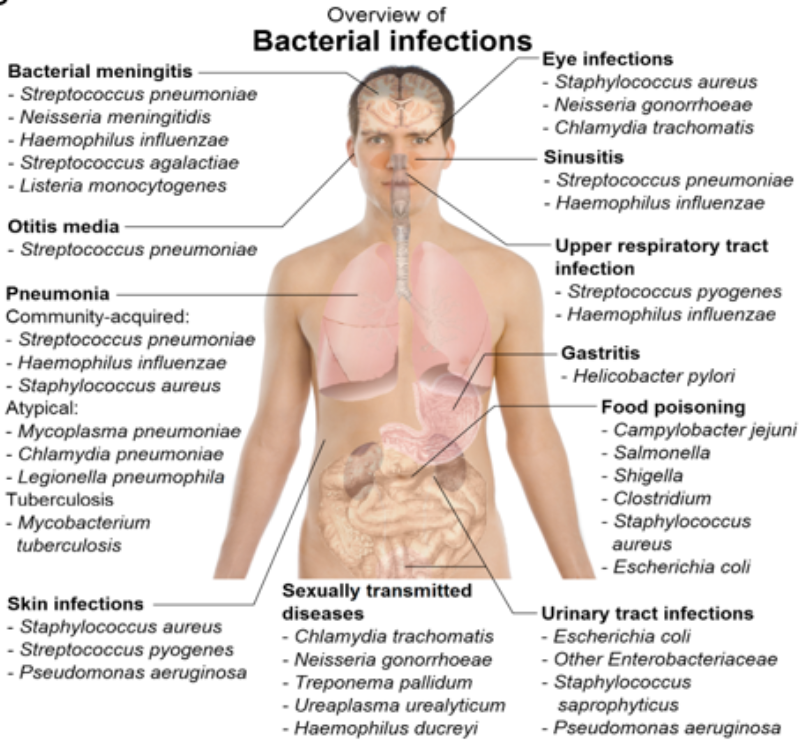 <ul><li><p>nucleoid, no nucleus</p></li><li><p>prokaryotes</p></li><li><p>divide by binary fission (asexual)</p></li><li><p>cell walls composed of peptidoglycan</p></li><li><p>infectious and non-infectious</p></li><li><p>food poisoning, salmonella, conjunctivitis, strep throat, cholera, etc.</p></li></ul><p></p>
