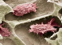 <p>Large, multinucleated cell that resorbs bone matrix.</p>