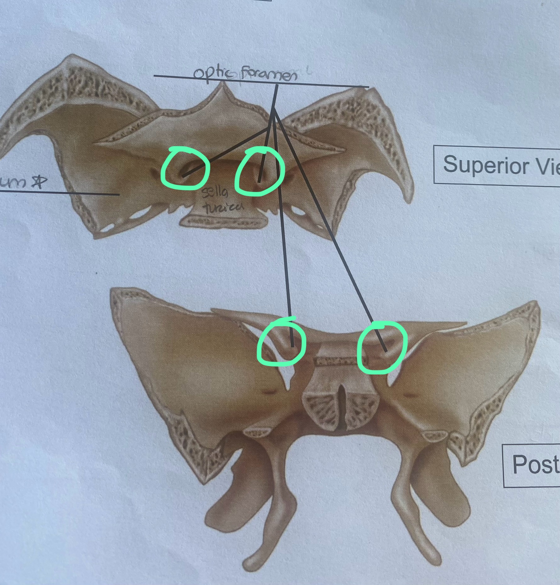 <p>part of sphenoid bone</p>