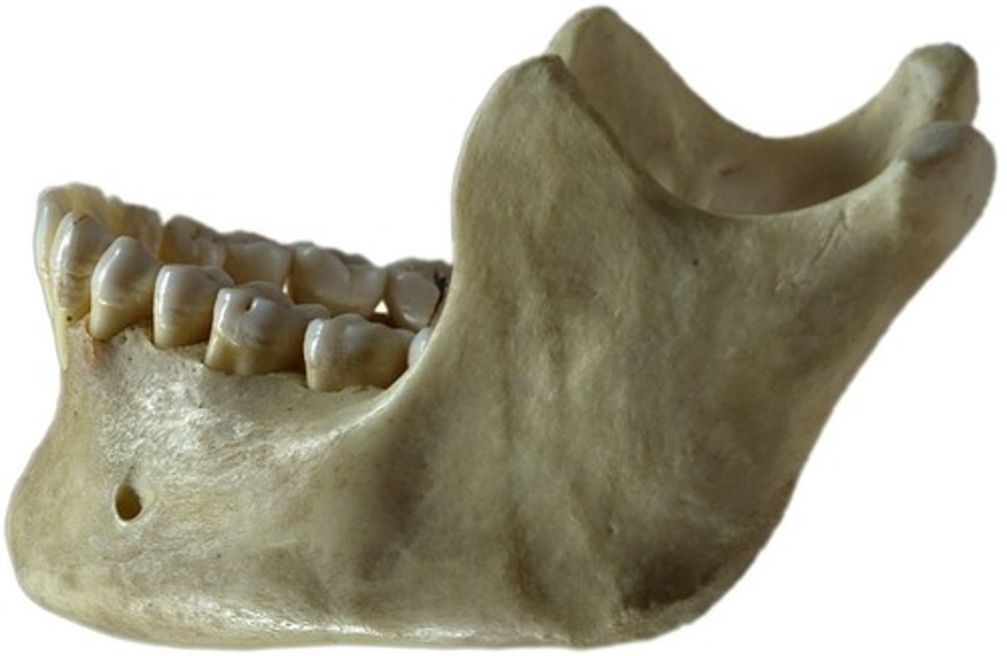 <p>jaw</p>
