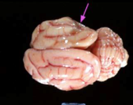 <p>What disease is this? What is the causative agent?</p>