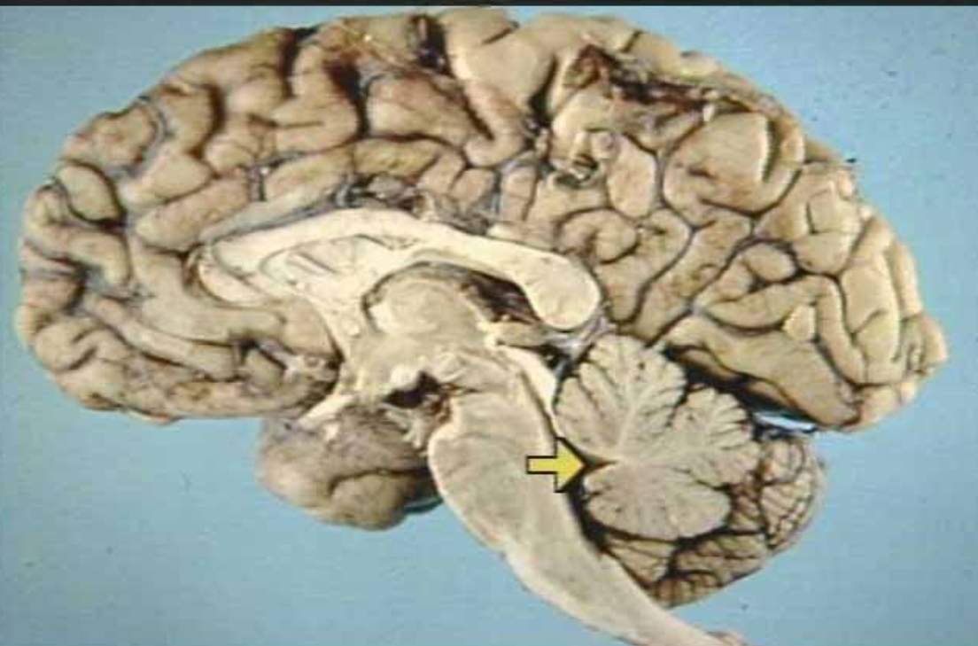 <p>What is the arrow pointing at?</p>