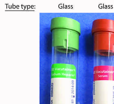 <p><span>Anticoagulant tubes</span></p>
