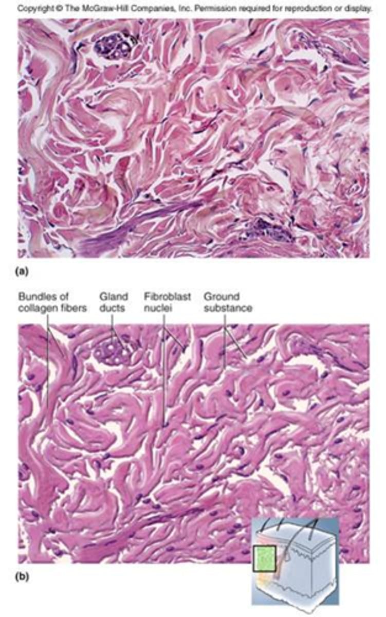 <p>Made up of collagen fibers that are densely packed but randomly arranged.</p><p>This can withstand stress in many directions.</p><p>Found in the dermis of the skin and in capsules around organs.</p>