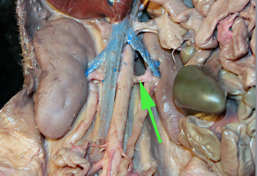 <p>The vessel marked by the green arrow is a <strong>renal </strong></p><p style="text-align: left">artery.</p>