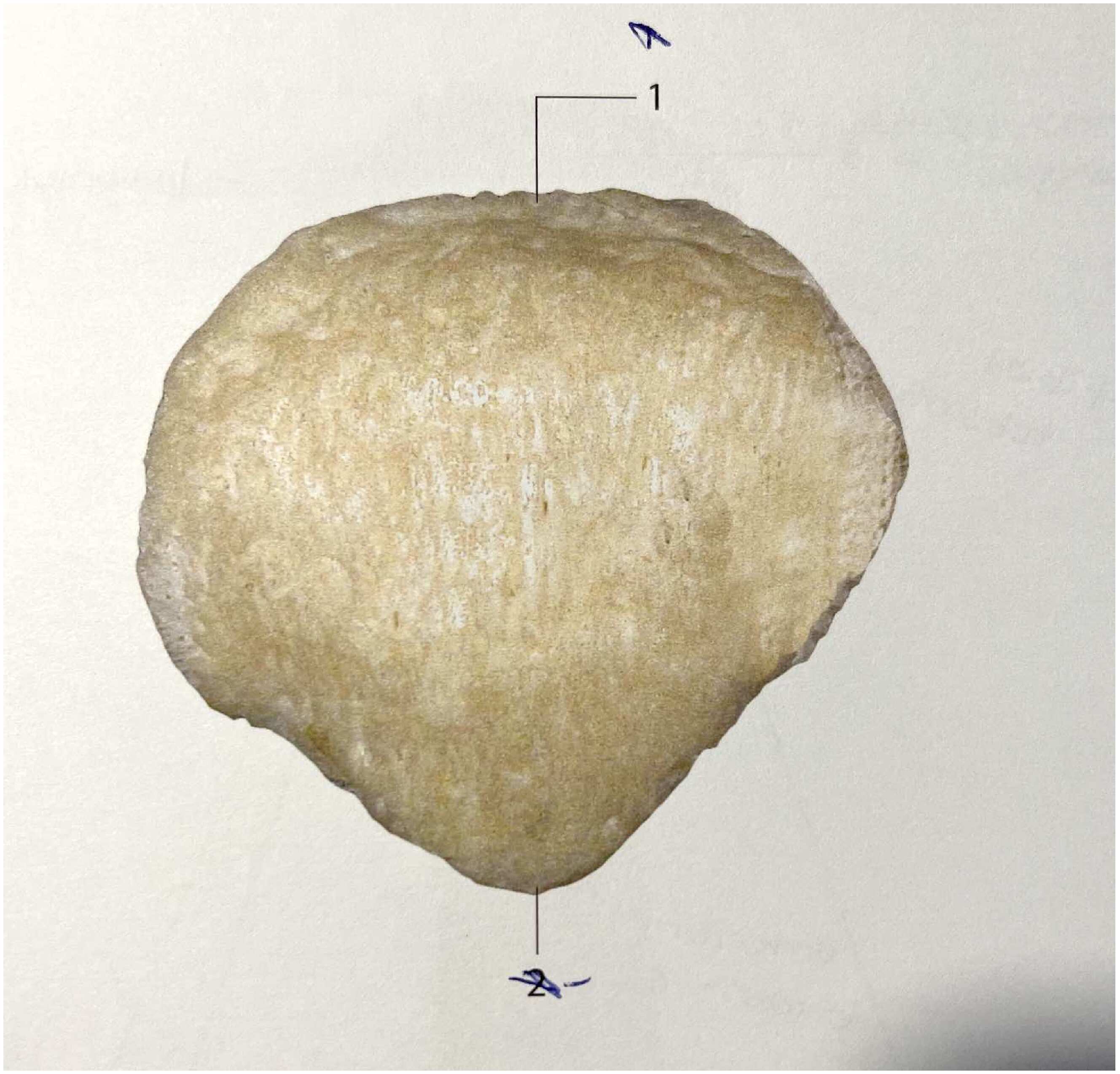 <p>What bone is this?</p>