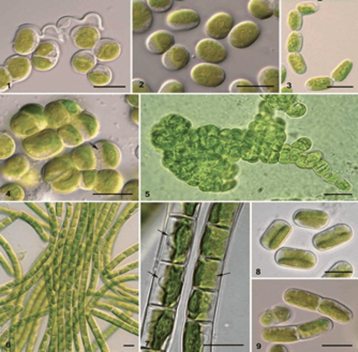 <p>branched filaments, unbranched filaments, and unicells</p>