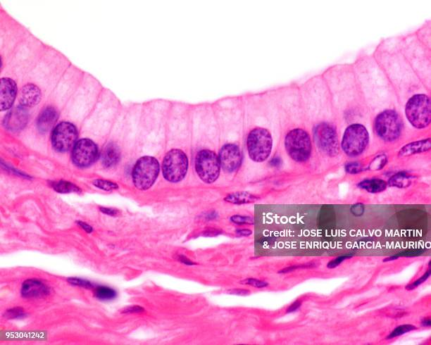 <p>What kind of Epithelia is this?</p>
