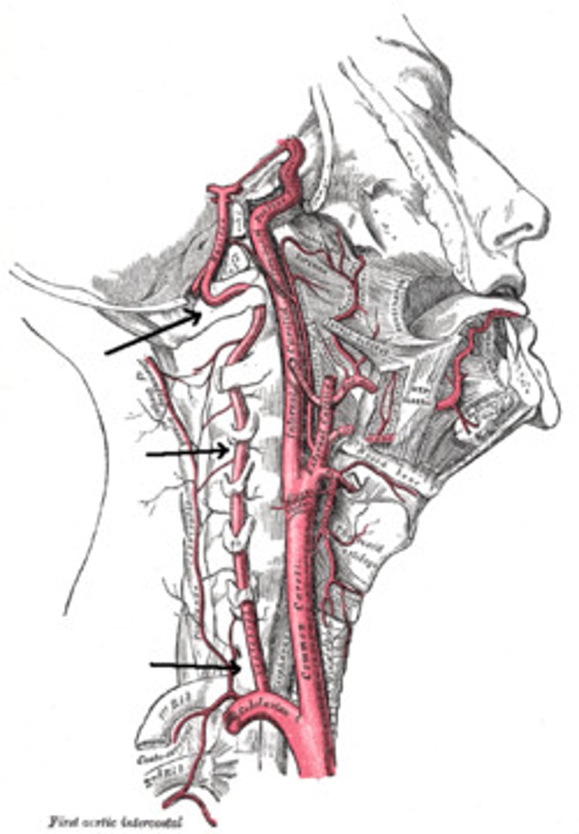 <p>What is this artery?</p>