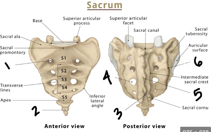 <p>Label the sacrum</p>