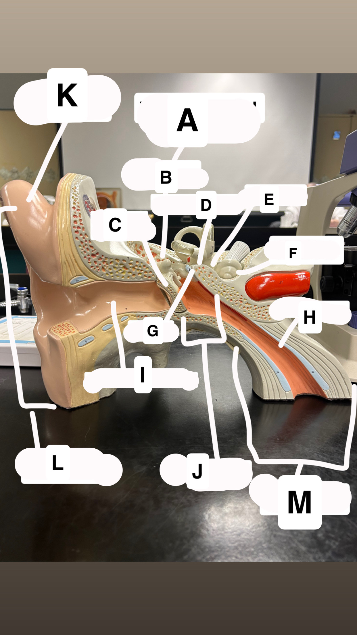 <p>A (Hint: behind malleus)</p>