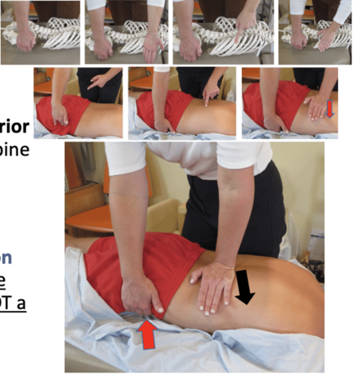 <p>• PP: Prone, a small roll may be placed under the patient's upper abdomen to induce flexion, permission to open gown/contact, identify finding segment</p><p>• DP: Square stance or modified fencer stance, on opposite side of contact, transferring weight anterior and superior against contact, tissue drawn from spine out to rib (M-L)</p><p>• CH: Cephalad hypothenar contact follows the rib angle lateral to the transverse process</p><p>• IH: Caudal fingers grasp the anterior ilium (ASIS) on the side of contact, pelvis should not rotate off the table more than 1-2 inches off the table (this is NOT a thrust) preadjustive tension</p><p>• LOD: P-A , I-S</p><p>* R7-R12</p>
