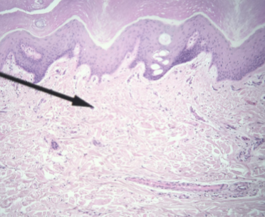 <p>what kind of tissue is this </p>
